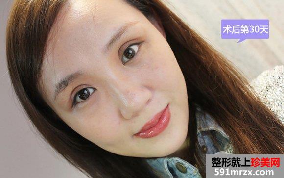 ���p��Ƥ���g(sh��)�֏�(f��)�r(sh��)�g����30��