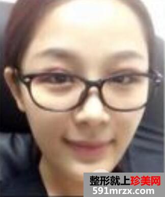 �nʽ�p��Ƥ�������·��팦�ȈD�ܽ^ʧ������