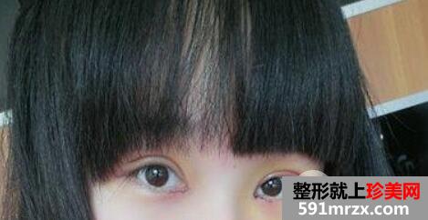 �p��Ƥ���_�۽����g2���»֏���Ч���^�̈D