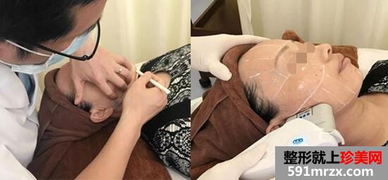 �����挍��������Ч���DƬ���沿�ί�ȫ�^��