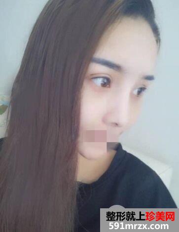 ���p��Ƥ���g�ļҺ�|�Ϻ��ⲩʿ�p��Ƥ���ΰ���Ч������