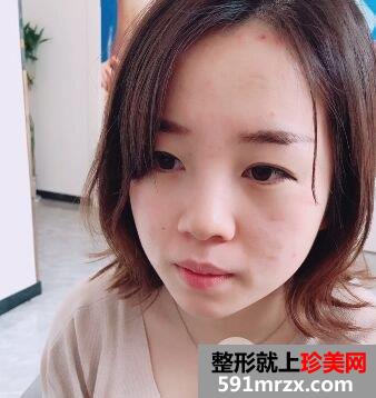 �W(w��ng)�t�����ײ��۱ǾC��+���w�|�°����˰�����(du��)�ȈD����