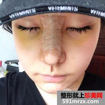 �Ϻ���˼�����΃r(ji��)���|�ǾC��+ȥ�۴��挍(sh��)��������