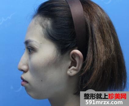 �Ϻ���Ժ�����沿֬�����r���15��֏��^�̈D����