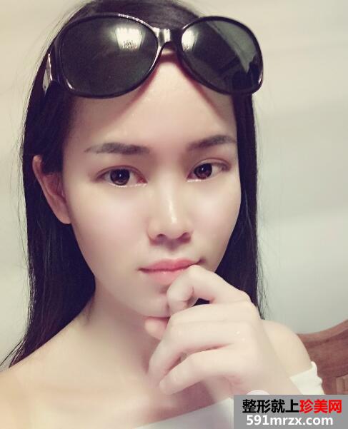���R�tԺ���ĸ��p��Ƥ�_�۽ǃr��ͻ֏��^�̈D �挍����