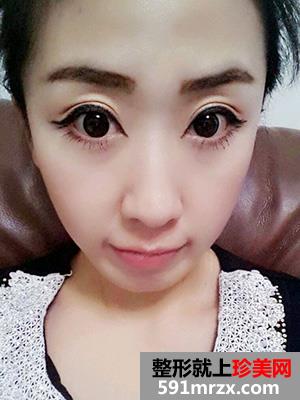 �߷������p��Ƥ���gǰ��Ч�����ȈD�ͻ֏��^��
