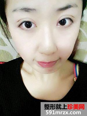 �߷������p��Ƥ���gǰ��Ч�����ȈD�ͻ֏��^��