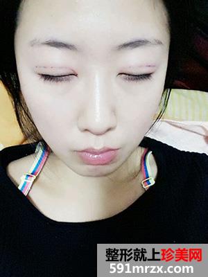 �߷������p��Ƥ���gǰ��Ч�����ȈD�ͻ֏��^��