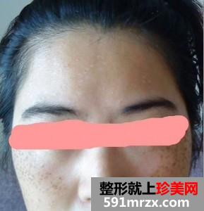 opt��������g�挍����������ǰ����Ƭ����