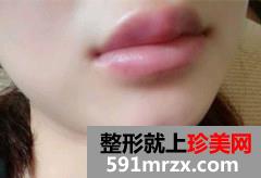 ע�䲣��������ϴ�ǰ�󌦱�Ч���DƬ�ͻ֏��^��