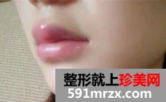 ע�䲣��������ϴ�ǰ�󌦱�Ч���DƬ�ͻ֏��^��
