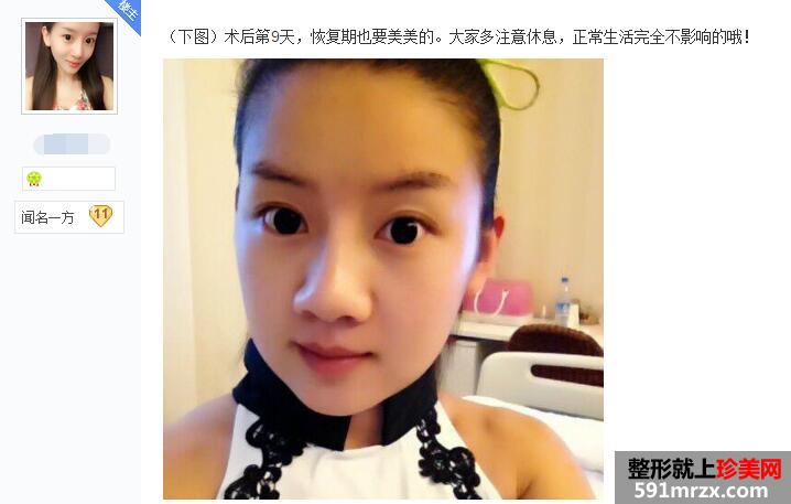 �N�ɷ������沿��֬�p���^�� �Ћ냺�ʵĿ��^��