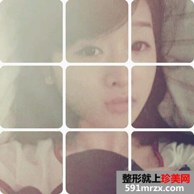 �nʽ���p��Ƥ���g(sh��)�挍(sh��)����������ǰ����Ƭ��(du��)��