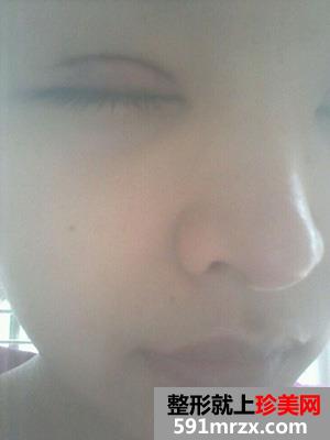 �nʽ���p��Ƥ���g(sh��)�挍(sh��)����������ǰ����Ƭ��(du��)��