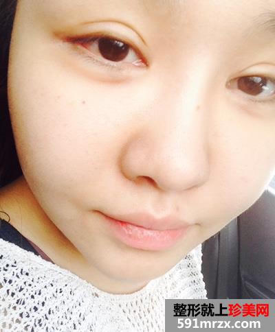 ���_���p��Ƥ�ޏ��gǰ��Ч�����ȈD�����κ�ӛ