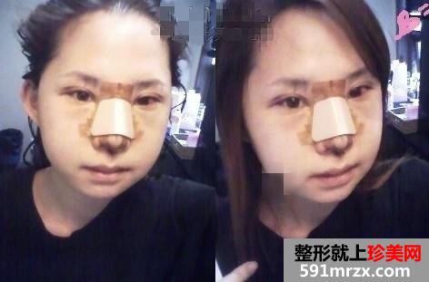 �沿�C���������gǰ�󌦱���Ƭ�����ͻ֏ͽ��v