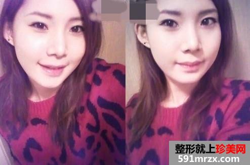 �沿�C���������gǰ�󌦱���Ƭ�����ͻ֏ͽ��v
