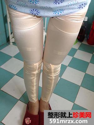 ���l��֬�ݴ����挍����������ǰ�󌦱���
