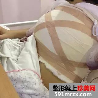 ����������w�S�����g�֏��^�̷�������ǰ�󌦱�Ч����Ƭ�ѣ�