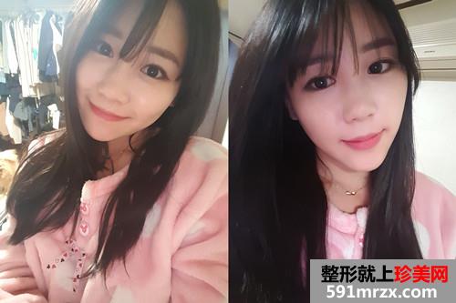 �nʽ����+���沿�����֏��^�̰���������ǰ�󌦱���