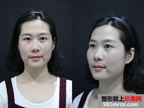��������䷨��yǰ��Ч�����ȈD�ͻ֏��^��