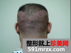 �������Ů���� �ڱ������˟o��ֲ�l