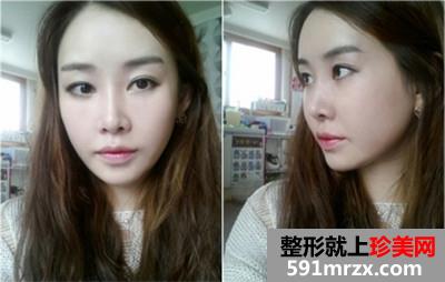 �沿݆��������+�ǾC�����g�挍����������ǰ�󌦱���