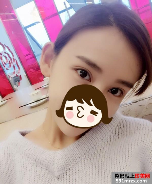 �����R÷�������沿��֬ Ч���ǳ���Ŷ