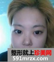 �沿��֬+�C��¡���挍��������