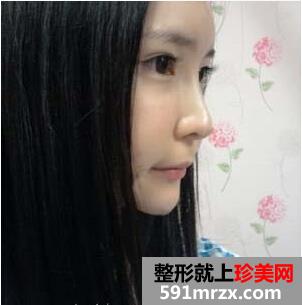 �ɶ��A�������tԺע�亣ޱ����������� �������Ч��