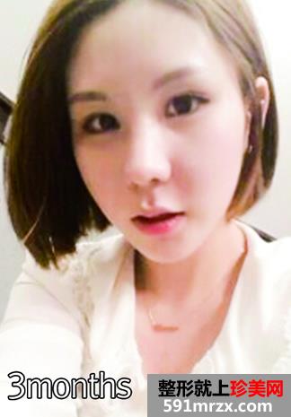 �ű������p��Ƥ���g�Ļ֏��^�̷���