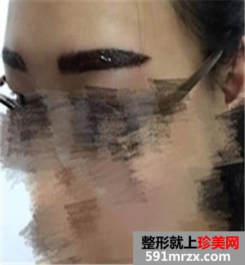�nʽ�����÷���ü�hü��ü�yüǰ�󌦱�Ч����Ƭ����