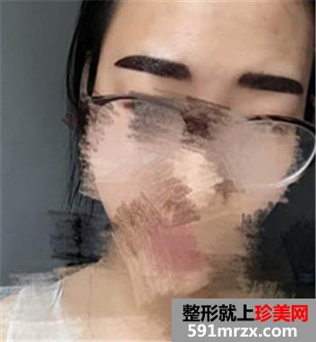�nʽ�����÷���ü�hü��ü�yüǰ�󌦱�Ч����Ƭ����