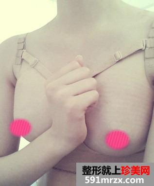 ���w¡��ǰ�󌦱� �Ϻ�õ����w¡����ӛ