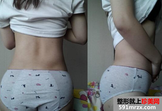 �Ȳ���֬+���w֬���S�����g��֏ͽ��v