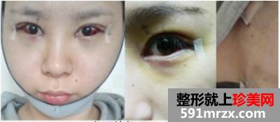 �߼�V݆���g+�_�����۽�ǰ��Ч�����ȈD�ͻ֏��^�̷���
