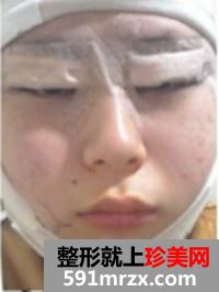 �߼�V݆���g+�_�����۽�ǰ��Ч�����ȈD�ͻ֏��^�̷���