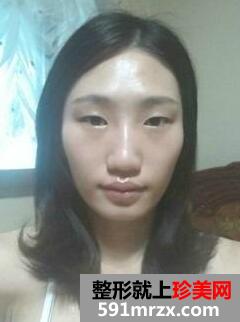 Ę�����ΰ��������� ���������挍�ɹ�����