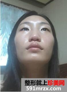 Ę�����ΰ��������� ���������挍�ɹ�����