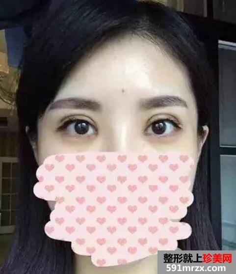 �p��Ƥ���g�֏�ȫ�^�� ÿ�ջ֏�ӛ�+ǰ��Ч�����ȈD