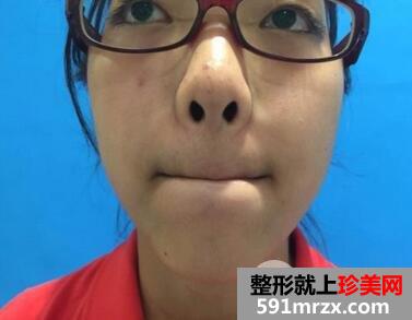 ȫ��ÓëҪ�����X2