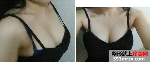 ���w¡��ǰ��֏�Ч�����ȈD