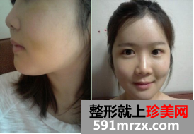 ���p��Ƥ+���z¡������+�沿�C�����λ֏���ӛ
