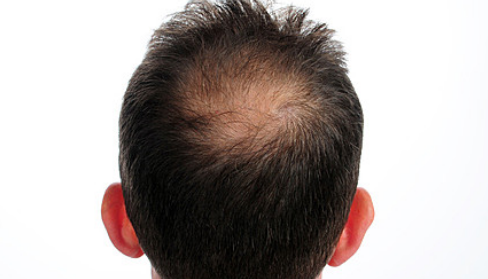 �L����Щ�t���C��������FUT�Nֲ�^�l?
