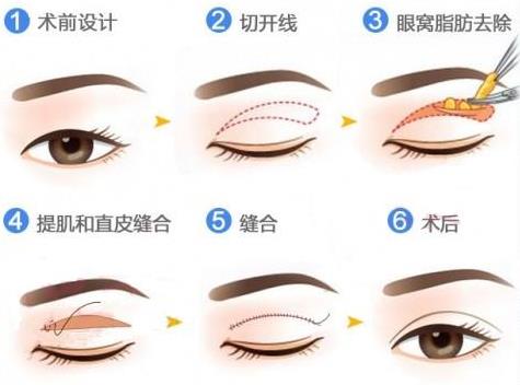 ȫ���p��Ƥ����֮��߀���񾀆�