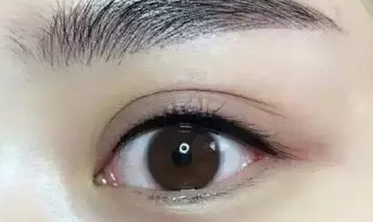 ���p��Ƥ�񾀵ĉ�̎