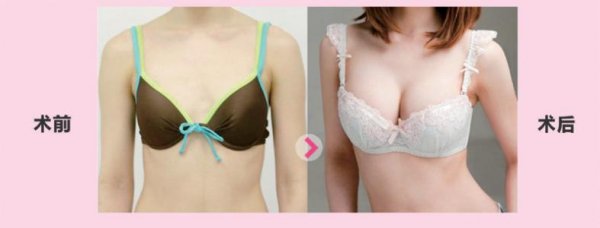 40�q�´����ز�������ô��