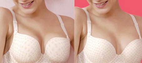 �Ϻ�ע��¡���ޏ̓r���Ƕ����X