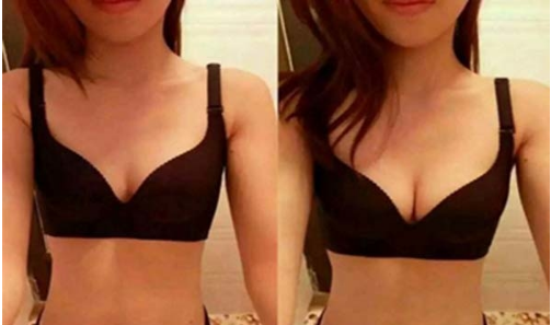 �����w֬���S�ػ֏���Ҫ���