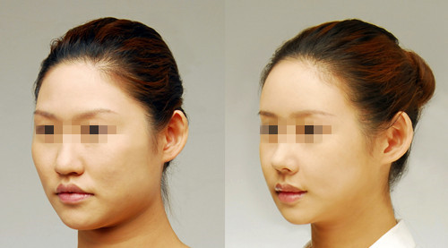 ֬���������ʲô�r�����[